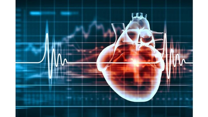 Is Heart Screening Necessary?