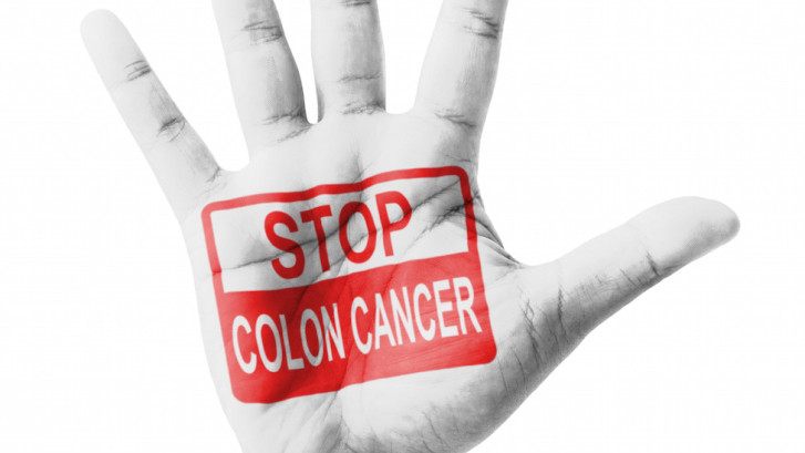 Colon Cancer: Prevention