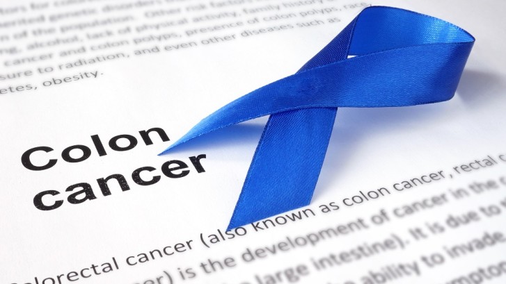 Colon Cancer: Signs and Symptoms