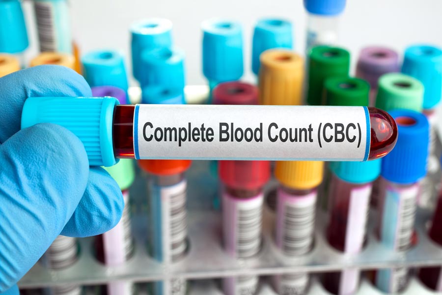 Gran CBC – Your Complete Blood Count, Explained